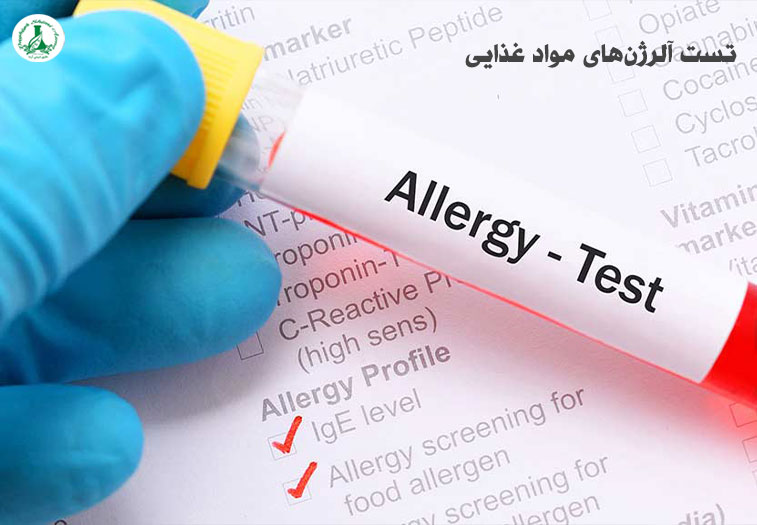 ۱۰ روش علمی تست آلرژن مواد غذایی | 09129483137